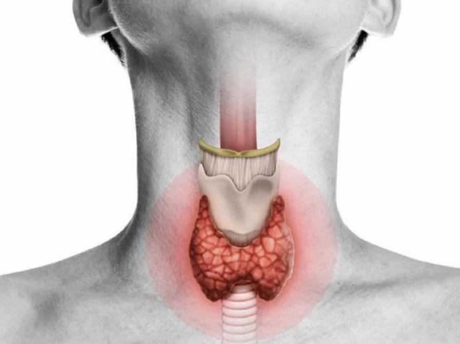 Hình ảnh minh họa vị trí tuyến giáp ở vùng cổ nơi các tế bào ung thư phát triển