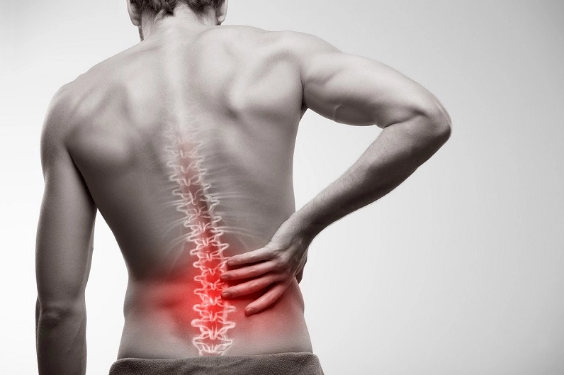 Minh họa các vị trí đau có thể xuất hiện trên khắp cột sống con người