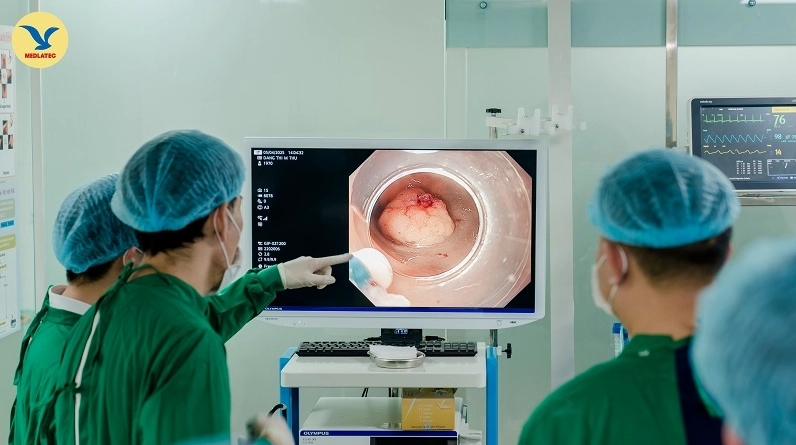 Bác sĩ đang thực hiện thủ thuật nội soi đại tràng cho bệnh nhân để chẩn đoán bệnh lý.