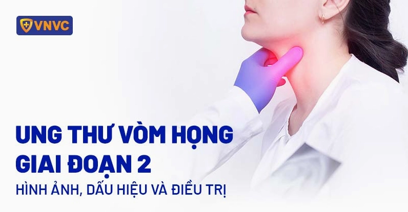 Mô tả hình ảnh ung thư vòm họng giai đoạn 2 khi khối u bắt đầu lan rộng