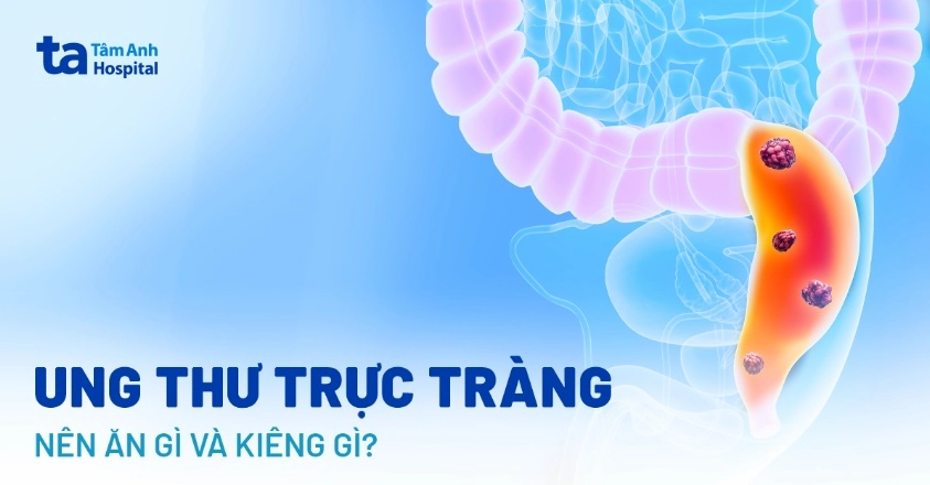 Một đĩa thức ăn lành mạnh bao gồm cá hồi, bông cải xanh, cà chua và các loại rau củ tốt cho bệnh nhân ung thư trực tràng.