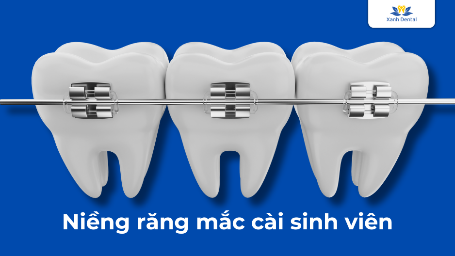 Nha khoa Nhổn uy tín – Chăm sóc răng miệng tại Xanh Dental