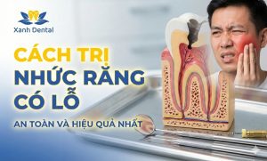 Bạn tìm địa chỉ nha khoa trẻ em Nhổn uy tín? Khám phá Nha Khoa Xanh Dental CS2 (93 Phố Nhổn) - khám răng cho bé nhẹ nhàng, bác sĩ tâm lý, không đau, giá tốt.